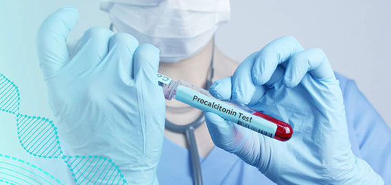 SingleB單抗發(fā)現(xiàn)技術(shù)攻克PCT檢測(cè)靈敏度難題 